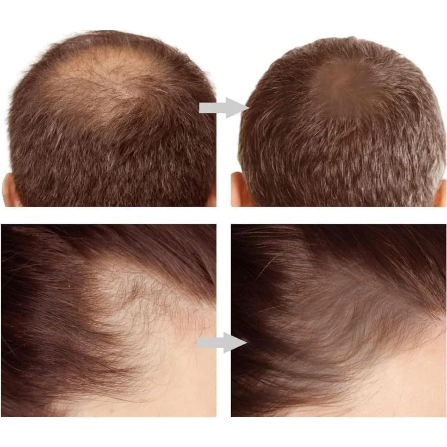 Hairline Powder, Hair Root Dye, Hair Loss Concealer, Quickly Fix Hair Roots, Hair Line Shadow Powder Cover Grey Hair, Hair Color Touch-Up, Men Women Thin Hair Mascara, Hairline Powder Stick Dark Brown